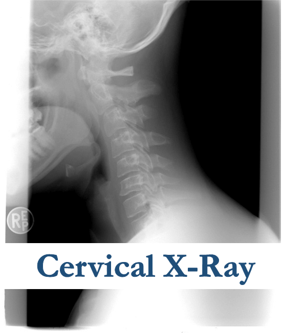 cervical x-ray
