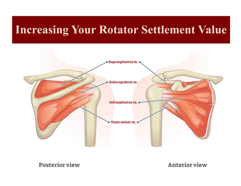 Increasing Rotator Cuff Settlement Value