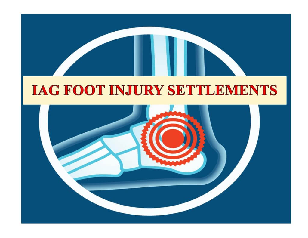 Foot Injury Settlements