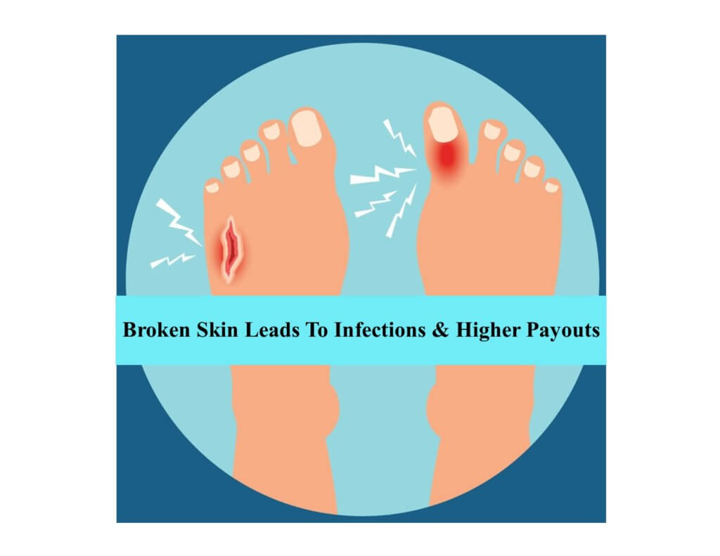 Infections and Broken Toes