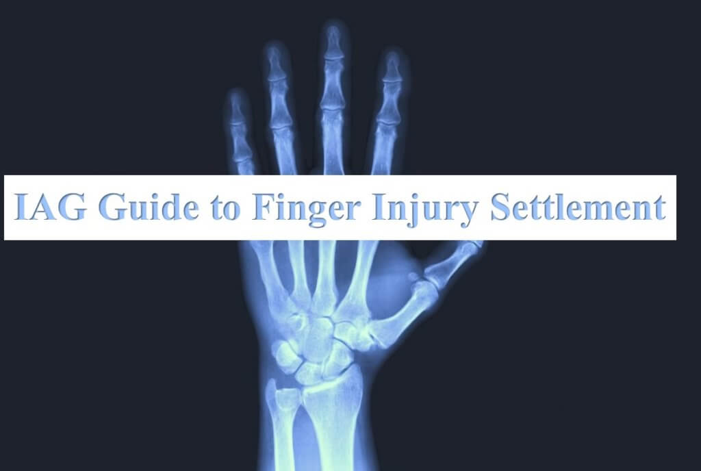 Finger Fracture Fixation  Central Coast Orthopedic Medical Group