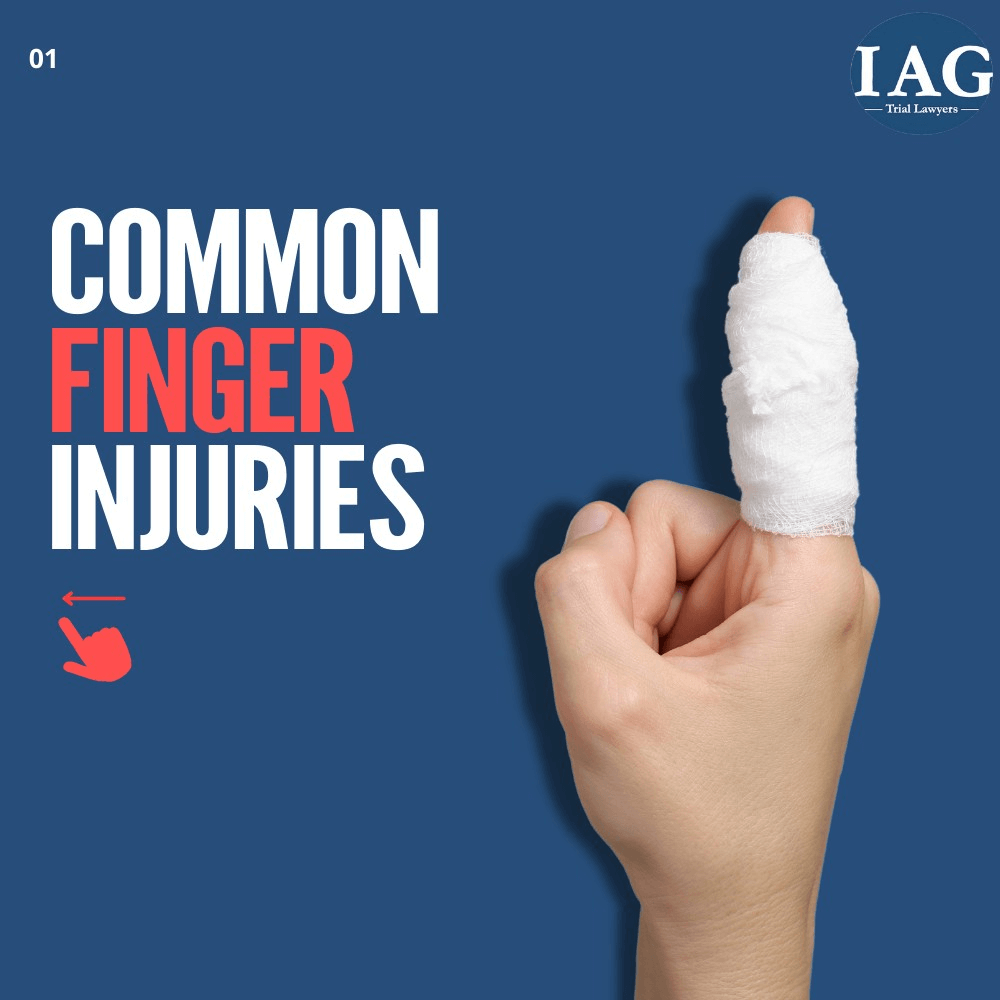 finger injury compensation