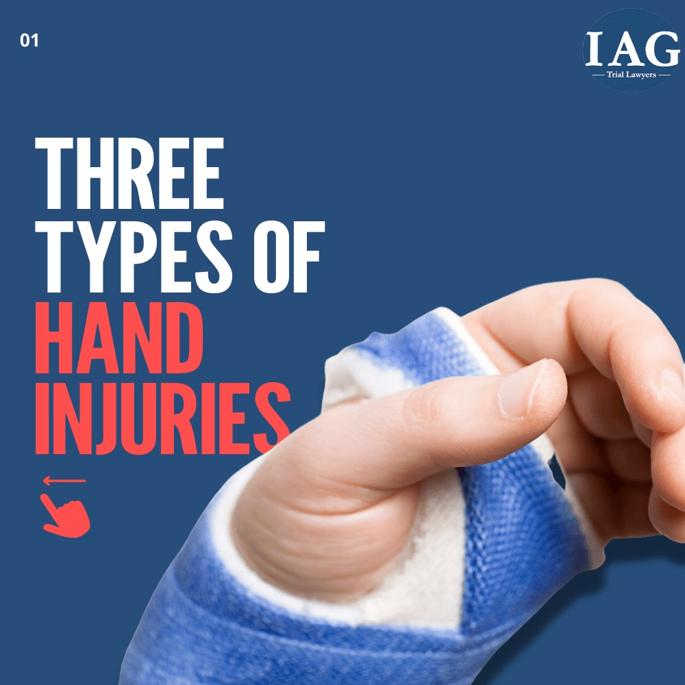 hand injury settlements