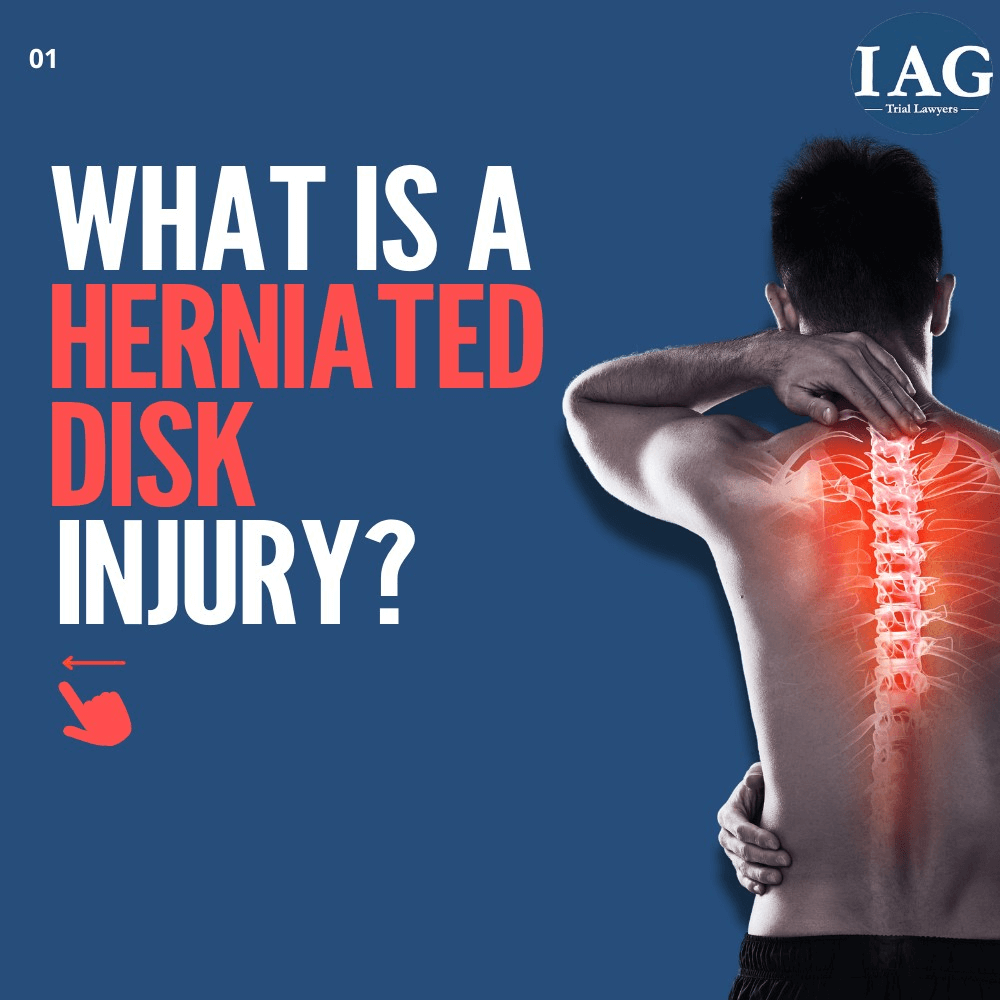 herniated disc injury settlements with steroid injections