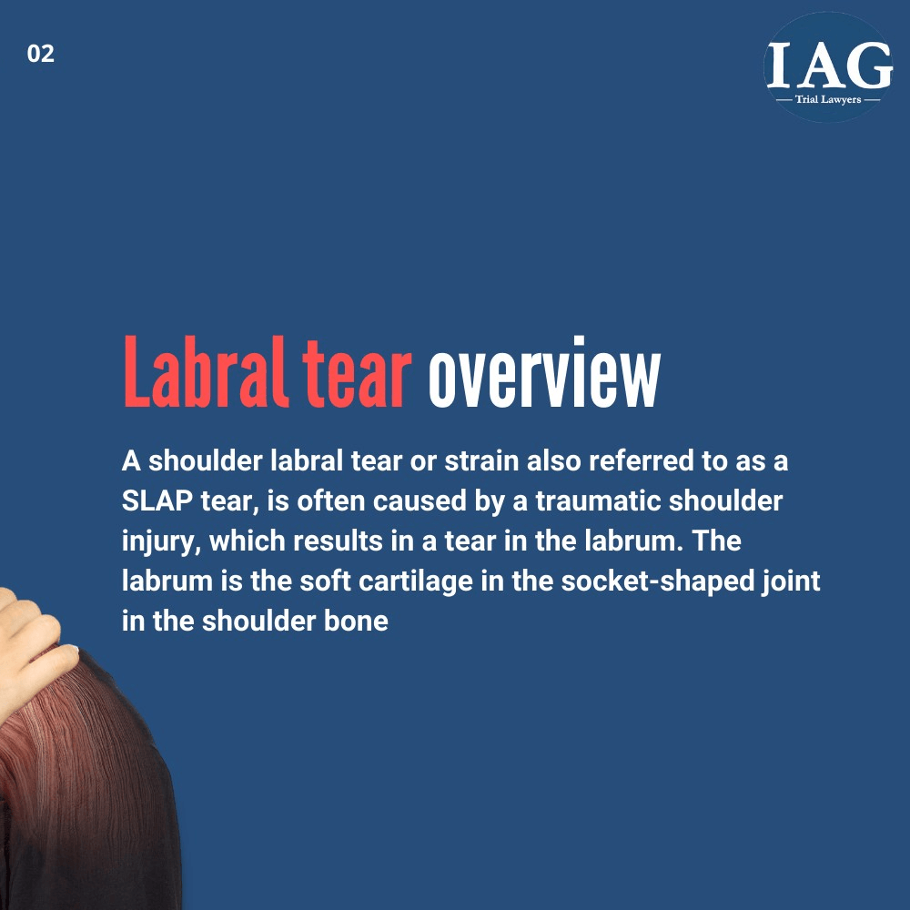 labral tear injury overview