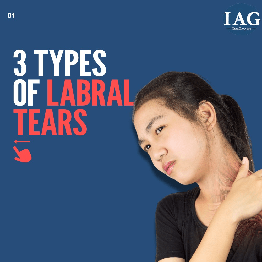 labral tear shoulder settlement