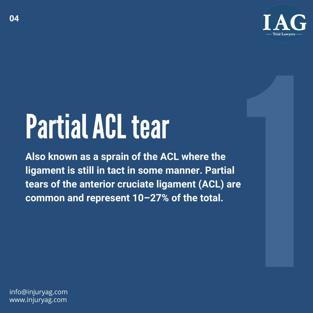 partial ACL tear injuries