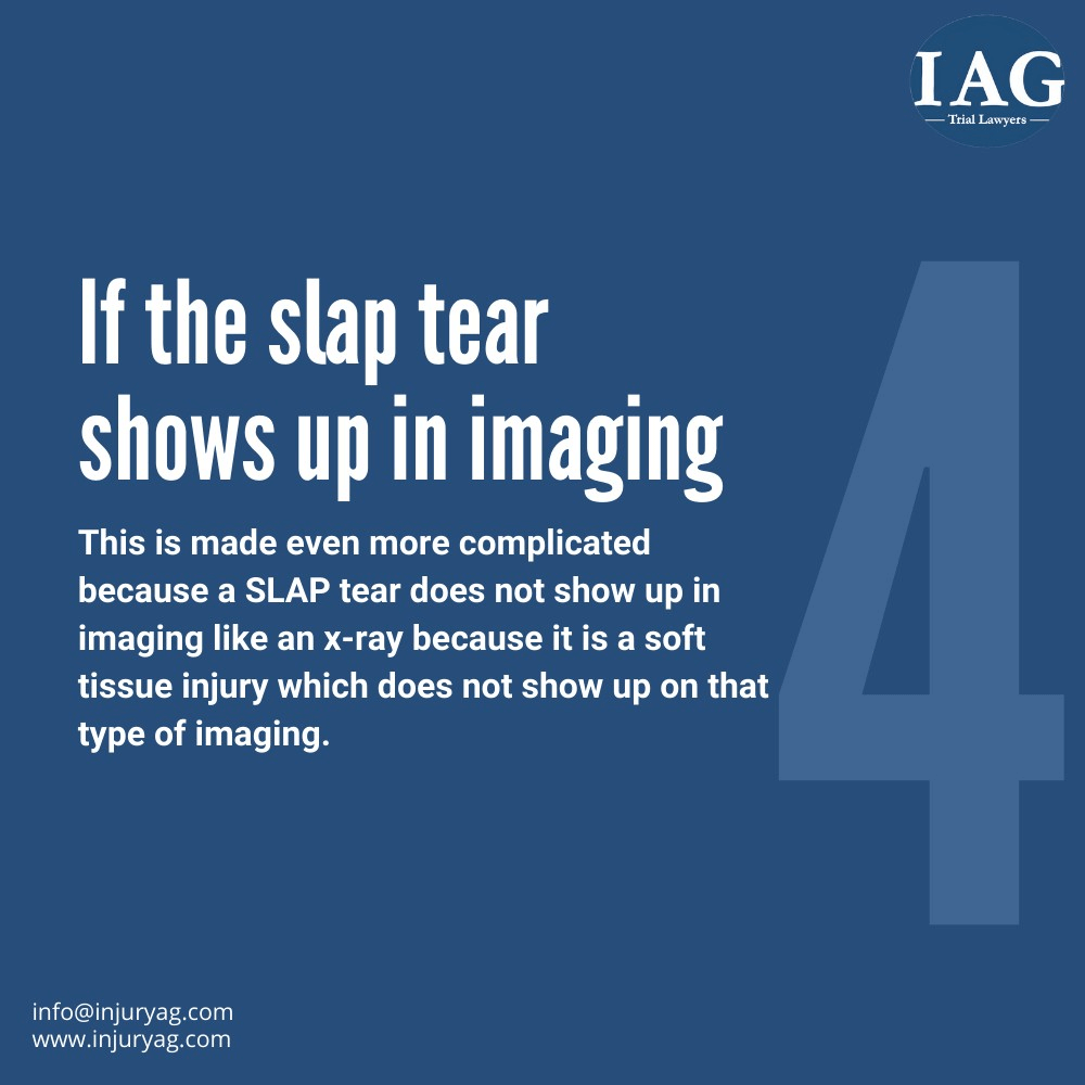 slap tear diagnostic imaging